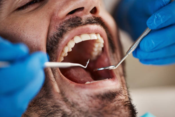Best Cosmetic Dentistry  in Longbranch, WA